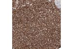 Immunohistochemical staining of human liver shows moderate to strong membranous positivity in hepatocytes.