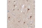 Immunohistochemical staining of human cerebral cortex shows moderate cytoplasmic positivity in neuronal cells.