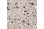 Immunohistochemical staining of human brain shows strong nuclear and cytoplasmic positivity in neurons.