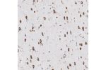 Immunohistochemical staining of human cerebral cortex shows moderate cytoplasmic positivity in neurons.