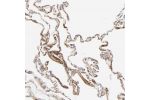 Immunohistochemical staining of human lung shows strong positivity in extracellular space in pneumocytes.