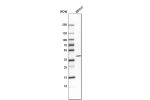 Western blot analysis in human cell line BEWO.
