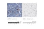 Immunohistochemistry analysis in human lymph node and skeletal muscle tissues using HPA003418 antibody. Corresponding GZMB RNA-seq data are presented for the same tissues.