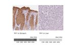 Immunohistochemistry analysis in human stomach and liver tissues using Anti-TFF1 antibody. Corresponding TFF1 RNA-seq data are presented for the same tissues.