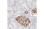 Immunohistochemical staining of human kidney shows strong membranous positivity in cells in glomeruli, while cells in tubules are negative.
