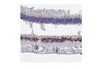 Immunohistochemical staining of human retina shows strong nuclear positivity in inner nuclear layer.