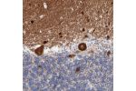 Immunohistochemical staining of human cerebellum shows strong cytoplasmic positivity in Purkinje cells.
