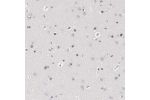 Immunohistochemical staining of human cerebral cortex shows moderate nuclear positivity in glial cells.