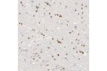 Immunohistochemical staining of human cerebral cortex shows strong nuclear positivity in glial cells.