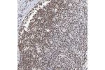 Immunohistochemical staining of human appendix shows nuclear positivity in lymphoid tissue.