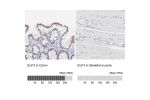 Immunohistochemistry analysis in human colon and skeletal muscle tissues using HPA003479 antibody. Corresponding ELF3 RNA-seq data are presented for the same tissues.