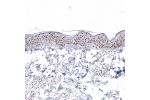 Immunohistochemical staining of human heart muscle shows moderate nuclear positivity in cardiomyocytes.
