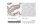 Immunohistochemistry analysis in human fallopian tube and liver tissues using HPA003505 antibody. Corresponding PBX1 RNA-seq data are presented for the same tissues.