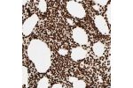 Immunohistochemical staining of human bone marrow shows strong nuclear positivity in hematopoietic cells.