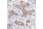 Immunohistochemical staining of human breast shows moderate cytoplasmic positivity in glandular cells.