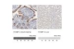 Immunohistochemistry analysis in human small intestine and liver tissues using HPA003517 antibody. Corresponding FCGBP RNA-seq data are presented for the same tissues.
