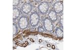 Immunohistochemical staining of human colon shows distinct positivity in endothelial cells.