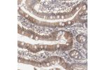 Immunohistochemical staining of human small intestine shows cytoplasmic and membranous positivity in glandular cells.
