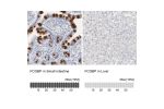 Immunohistochemistry analysis in human small intestine and liver tissues using HPA003564 antibody. Corresponding FCGBP RNA-seq data are presented for the same tissues.