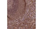 Immunohistochemical staining of human Spleen shows strong nuclear and cytoplasmic positivity in cells in white and red pulp.