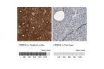 Immunohistochemistry analysis in human cerebral cortex and pancreas tissues using Anti-NDRG2 antibody. Corresponding NDRG2 RNA-seq data are presented for the same tissues.