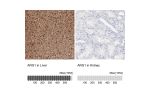 Immunohistochemistry analysis in human liver and kidney tissues using HPA003595 antibody. Corresponding ARG1 RNA-seq data are presented for the same tissues.