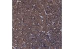 Immunohistochemical staining of human lymph node shows strong cytoplasmic positivity in non-germinal center cells.