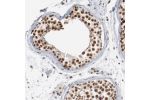 Immunohistochemical staining of human testis shows strong nuclear positivity in cells in seminiferous ducts.