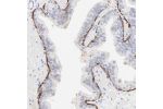 Immunohistochemical staining of human prostate shows strong positivity in myoepithelial cells.