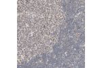 Immunohistochemical staining of human cerebral cortex shows strong nuclear positivity in neuronal cells and glial cells.