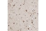 Immunohistochemical staining of human caudate shows strong nuclear positivity in glial cells.