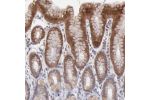 Immunohistochemical staining of human urinary bladder shows cytopalsmic positivity in urothelial cells.