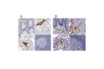 Immunohistochemical staining of human colon, kidney, lung and lymph node using Anti-APOH antibody HPA003732 (A) shows similar protein distribution across tissues to independent antibody HPA001654 (B).