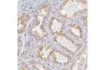 Immunohistochemical staining of human kidney shows moderate membranous positivity in cells in tubules.