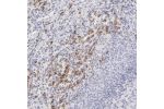 Immunohistochemical staining of human spleen shows strong cytoplasmic positivity in cells in red pulp.