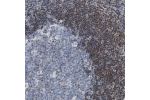 Immunohistochemical staining of human lymph node shows strong nuclear positivity in non-germinal center cells.