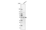 Western blot analysis in human cell line NTERA-2.