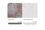 Immunohistochemistry analysis in human tonsil and cerebral cortex tissues using Anti-CD2 antibody. Corresponding CD2 RNA-seq data are presented for the same tissues.