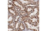 Immunohistochemical staining of human kidney shows strong cytoplasmic positivity in cells in tubules.