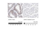Immunohistochemistry analysis in human testis and skeletal muscle tissues using HPA003890 antibody. Corresponding ADAR RNA-seq data are presented for the same tissues.