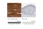 Immunohistochemistry analysis in human skeletal muscle and heart muscle tissues using Anti-BIN1 antibody. Corresponding BIN1 RNA-seq data are presented for the same tissues.
