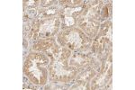 Immunohistochemical staining of human kidney shows moderate cytoplasmic positivity in cells in tubules.
