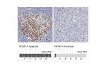 Immunohistochemistry analysis in human appendix and pancreas tissues using Anti-MCM7 antibody. Corresponding MCM7 RNA-seq data are presented for the same tissues.