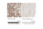 Immunohistochemistry analysis in human placenta and skeletal muscle tissues using HPA003903 antibody. Corresponding VSIG4 RNA-seq data are presented for the same tissues.