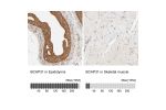 Immunohistochemistry analysis in human epididymis and skeletal muscle tissues using Anti-BCAP31 antibody. Corresponding BCAP31 RNA-seq data are presented for the same tissues.