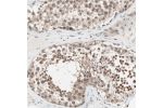Immunohistochemical staining of human testis shows moderate to strong nuclear positivity in cells in seminiferous ducts.