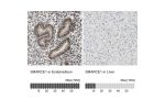 Immunohistochemistry analysis in human endometrium and liver tissues using Anti-SMARCE1 antibody. Corresponding SMARCE1 RNA-seq data are presented for the same tissues.