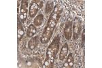 Immunohistochemical staining of human duodenum shows moderate cytoplasmic positivity in glandular cells.