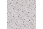 Immunohistochemical staining of human cerebral cortex shows moderate nuclear positivity in neurons.