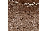 Immunohistochemical staining of human cerebellum shows very strong cytoplasmic positivity in astrocytes.